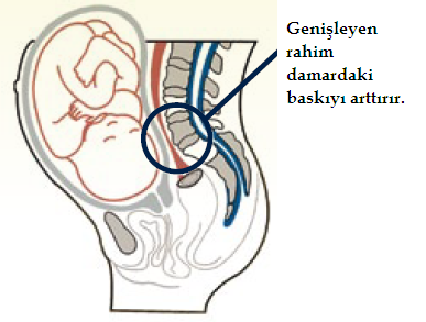 Gebelikte VAris